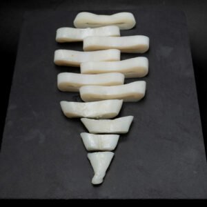 Anillo de calamar